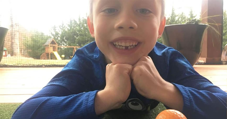 Video, cómo sacarse un diente con un swing de golf